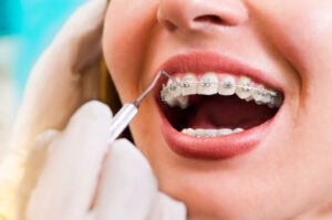 orthodontics lansdale pa