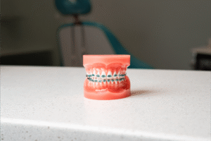 Model of teeth with metal braces on a countertop, representing BZ Orthodontics' orthodontic services in Lansdale, PA.