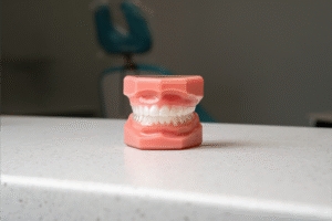 Model teeth demonstration in BZ Orthodontics office, showcasing orthodontic care and Invisalign options in Lansdale, PA.