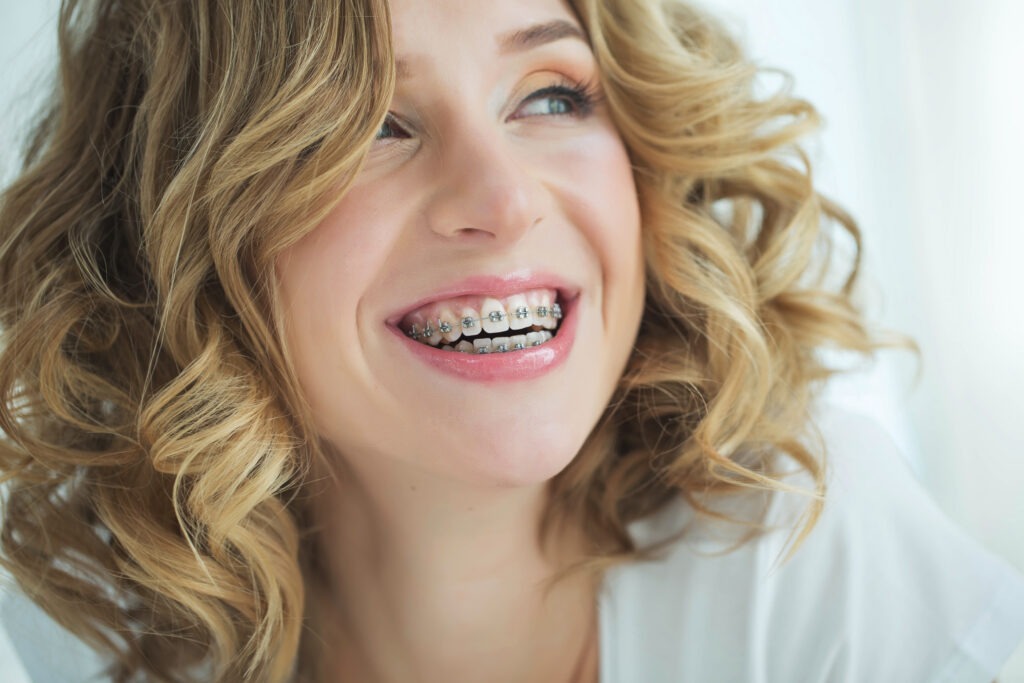 Braces vs Invisalign: Which Is Better for Adults?