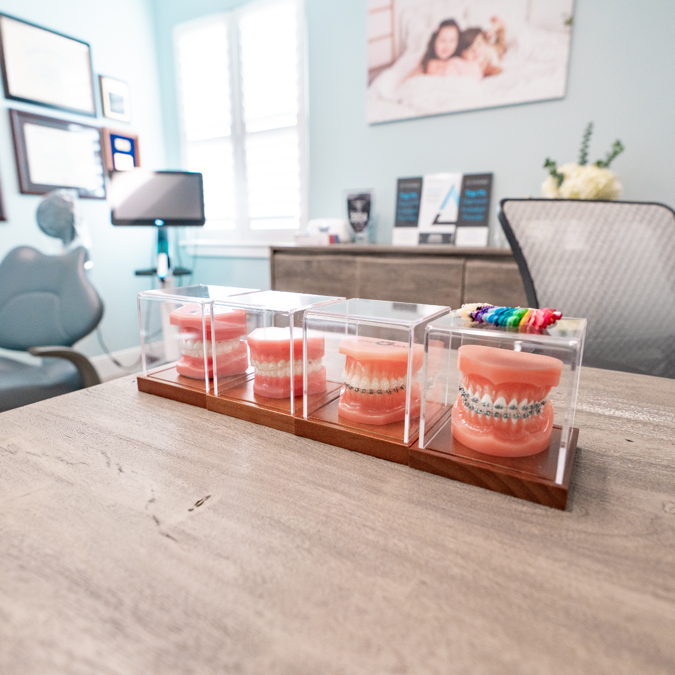 Row of orthodontic teeth models with braces on a desk in the consultation room